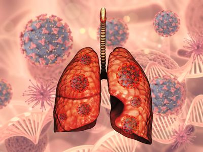 How Personalized Medicine Is Changing Mesothelioma Treatment Plans