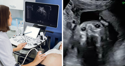 Pregnant Woman’s Sonogram Image Goes Viral After She Spots Hilarious Detail