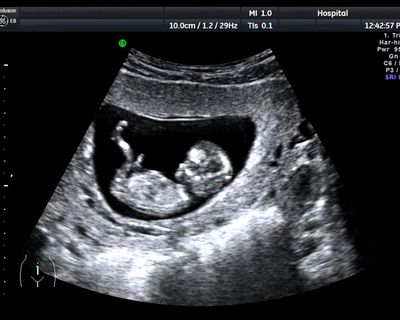 UK’s unregulated pregnancy scan clinics putting lives in danger, say experts