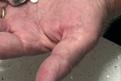 Scientists warn this common supplement could be silently harming your heart