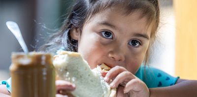 Peanut allergies have dropped dramatically in the US. Is that likely to happen in Australia?