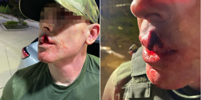 ICE Officer Burned in Metal Cup Attack During Houston Arrest; DHS Links Assault to Surge in Threats Nationwide