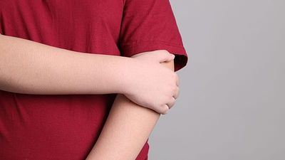 Childhood obesity reaching ‘alarmingly high’ levels in Europe, WHO report warns