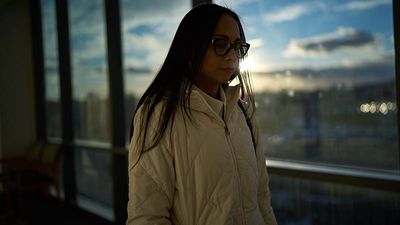 Lupus, the disease of 1,000 faces, shows how science is tackling mysterious autoimmune conditions