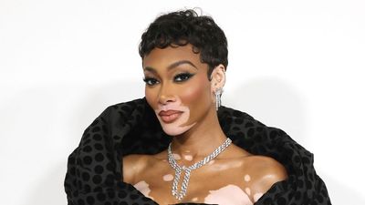 How Winnie Harlow’s Voluminous, Gold-Adorned Christmas Tree Is Redefining Holiday Decor for Fans of Sparkle and Nostalgia
