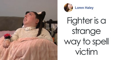 Woman Born Without Most Of Her Brain Turns 20, Family Speaks Out And It Sparks A Heated Debate