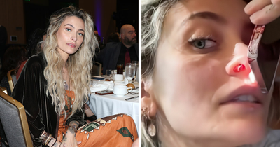 “It Ruined My Life”: Paris Jackson Reveals How Substance Use Deformed Her Face