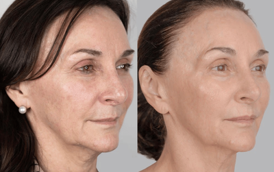 Shirley Ballas reveals glowy skin secrets after saying she feels '20 years younger'