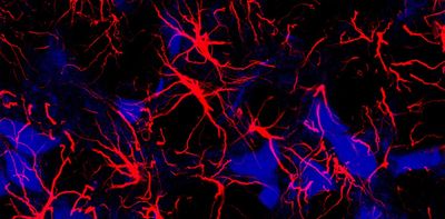 Star-shaped cells make a molecule that can ‘rewire’ the brains of mice with Down syndrome – understanding how could lead to new treatments