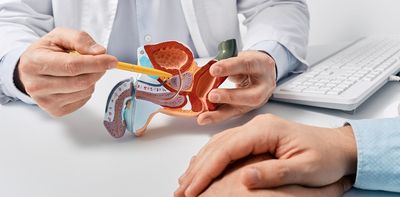 NHS trials AI tool for faster prostate cancer diagnosis