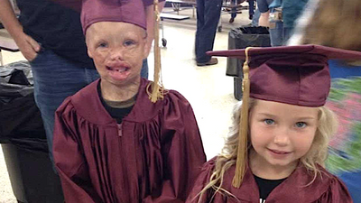 An 18-month-old barely survived a Texas fire that burned 84% of his body. Then, 16 years later, he achieved this coveted crown