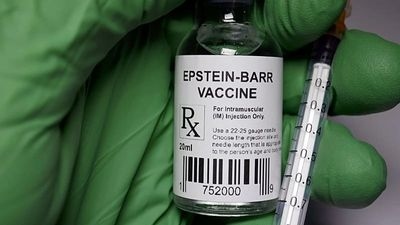 Common virus that causes mono identified as likely trigger for lupus autoimmune disease