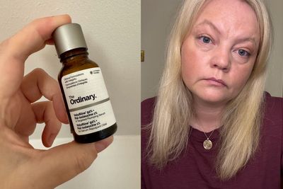 I tried the viral ‘filler in a bottle’ serum – and it made me look ‘more youthful’ in my 40s