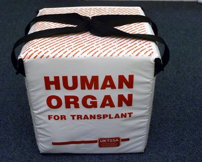 New AI tool could cut wasted efforts to transplant organs by 60%