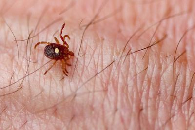New Jersey pilot, 47, becomes first known death from red meat allergy caused by a tick bite