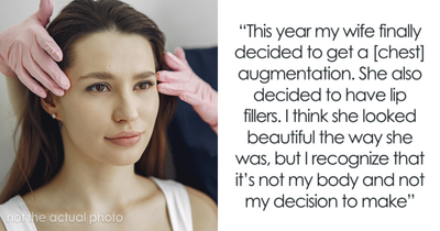 Man Struggles To Accept ‘New Wife’ After Plastic Surgery, Gets Honest When She Asks Him What He Thinks