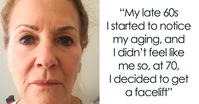 Woman Shares Her Aging Progress And How She Looks After Getting A Facelift At 70 Years Old