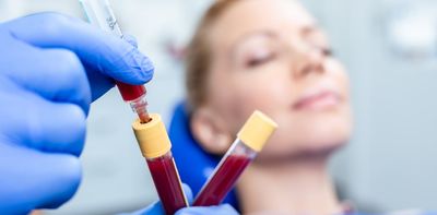 Would you put period blood on your face? What science says about ‘menstrual masking’