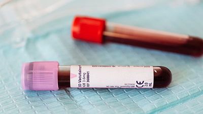 Ethiopia confirms 3 deaths from Ebola-like Marburg virus in new outbreak