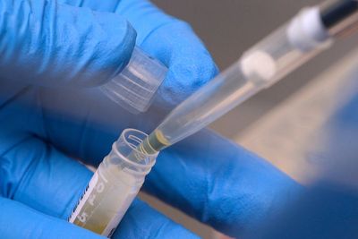 NIH funding cuts have affected over 74,000 people enrolled in experiments, a new report says