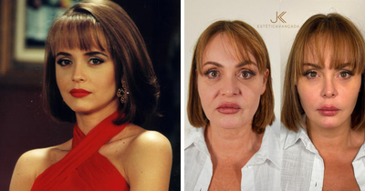 Fans Divided After Plastic Surgery Clinic Shares ‘Unrecognizable’ Before-After Pictures Of Actress