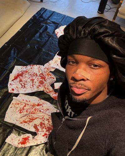 D4vd Named Suspect in Teen Girl's Trunk Death as Investigation Deepens