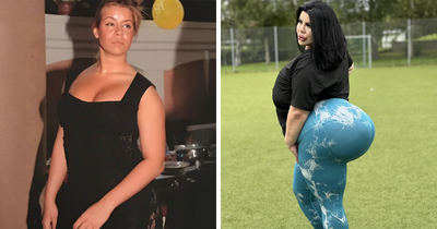 15 Women Who Got Plastic Surgeries For Their Behinds And Paid A Tragic Price For It