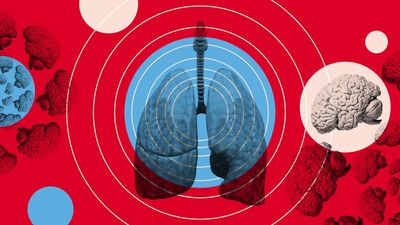 There are 8 patterns for long COVID symptoms. Here's what they are