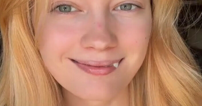 40 Beautiful Photos Showing People Celebrating What Makes Them Unique