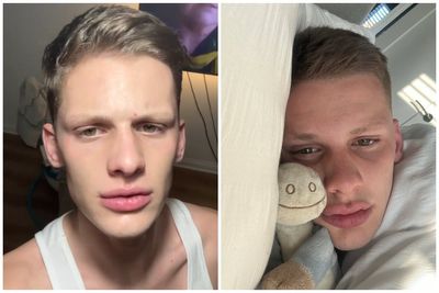 Freddy Brazier says he ‘attempted to end it all’ in manic episode as he opens up about mental health battle