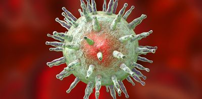 Lupus may be triggered by a common virus – new research