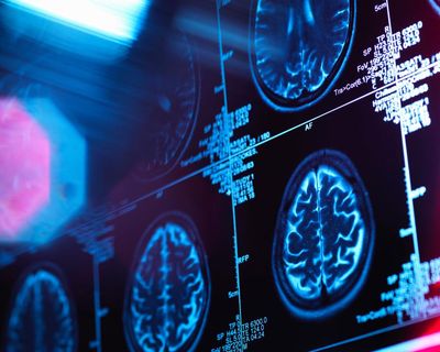 Brain has five ‘eras’, scientists say – with adult mode not starting until early 30s