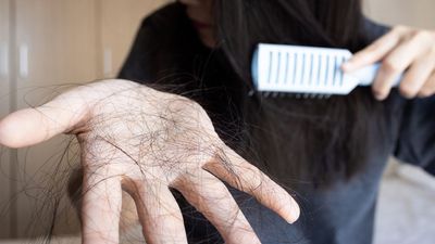 We may finally understand stress-induced hair loss