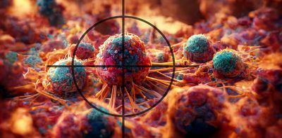 Histotripsy: how sound waves could change the future of tumour treatment