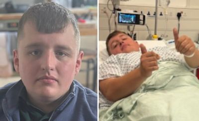 London cyclist who shattered leg in horror Lime e-bike smash among compensation claimants against hire firm