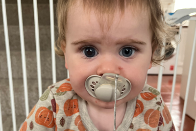 Toddler diagnosed with rare cancer after common viral illness has eye removed