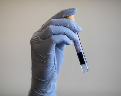 Expert panel advises against prostate cancer screening for most men in UK