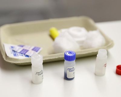 Testing at A&Es part of plan to end new HIV cases in England by 2030