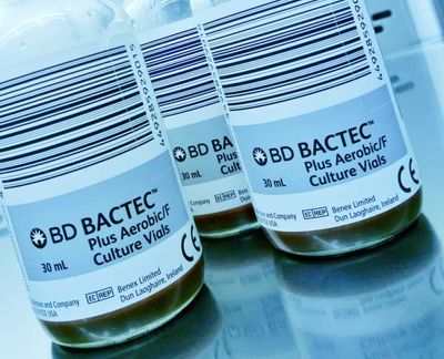 Is Becton, Dickinson and Company Stock Underperforming the Nasdaq?