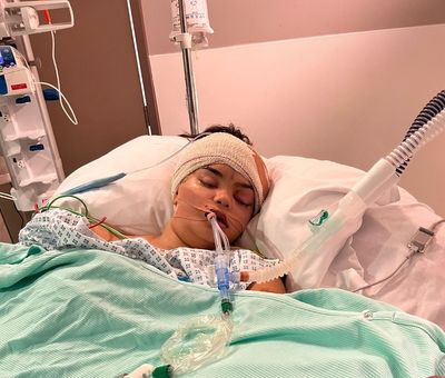 London teen horrified to discover itchy eye was killer brain infection
