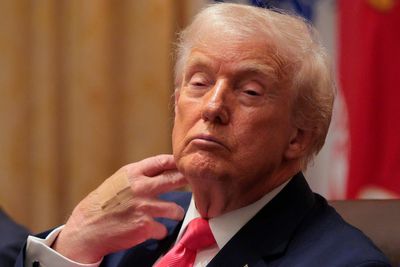 Trump appears with Band-Aids on the back of his hand as he complains about questions over his health