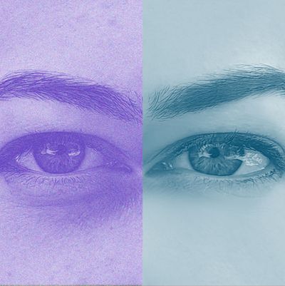 Everything You Need to Know About Under-Eye Filler Before Booking an Appointment