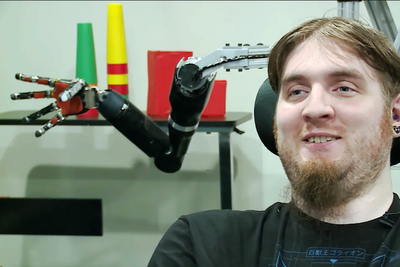 Neuralink patients can now control robotic arms with their thoughts