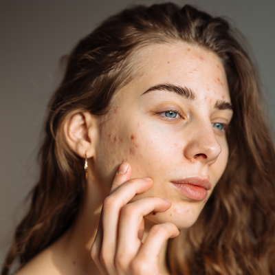 The Quiet Death of Skin Positivity