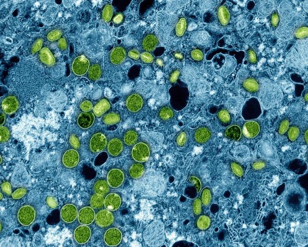 England health officials identify newly evolved strain of mpox