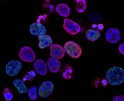 Stem Cell Therapy Uses: What Regenerative Medicine Can Treat—and the Stem Cell Risks to Know