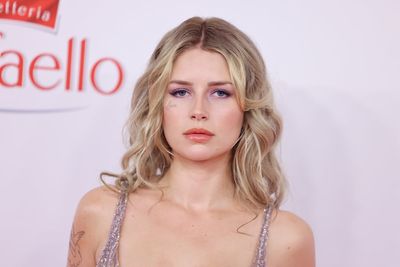 Lottie Moss almost completes removal of face tattoo