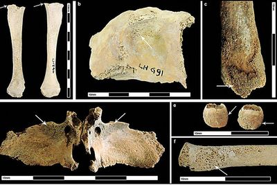 Roman occupation brought new diseases to Britain, archaeologists find