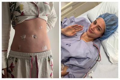 Lili Reinhart reveals endometriosis diagnosis after eight doctors failed to spot condition