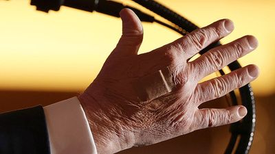 White House finally reveals why Trump keeps showing up with bandages on his hands, but the explanation is only raising more questions